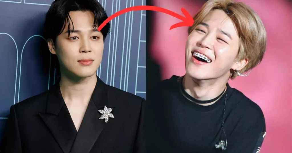 Pourquoi Jimin de BTS voulait-il un appareil dentaire ?